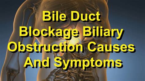 symptoms of bile leak|Bile Duct Obstruction: Symptoms, Causes & Treatment